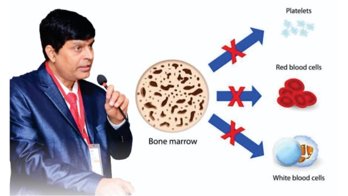 Advanced Homeopathy treatment brings New Hope to Aplastic Anemia Patients: Dr. A.K. Dwivedi’s Efforts Shine